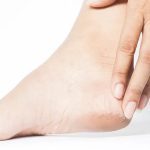 obat kapalan di kaki