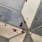 cara mengobati batuk dahak berdarah 2