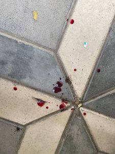 cara mengobati batuk dahak berdarah 2